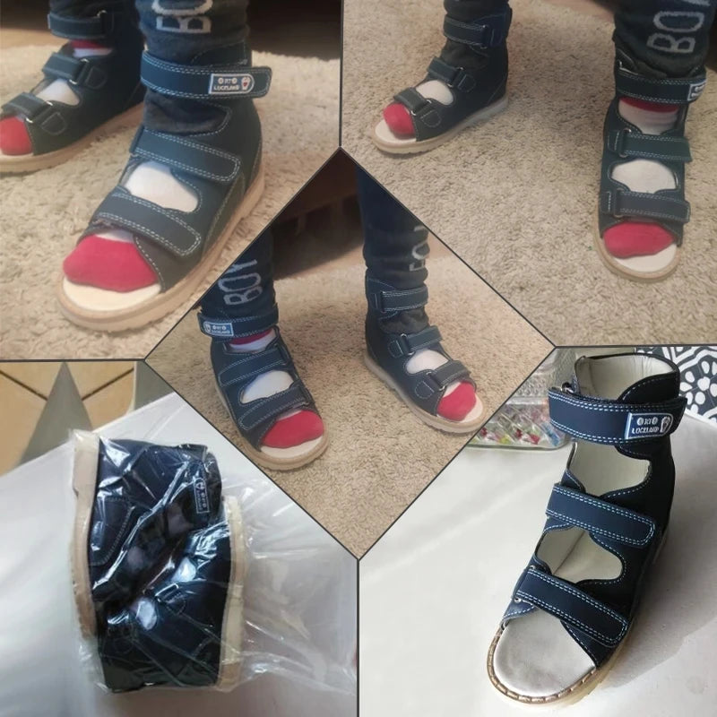 Summer Children Orthopedic Sandal for Kid Baby Toddler Boys Medical Shoes Flatfeet with Arch Support Insole